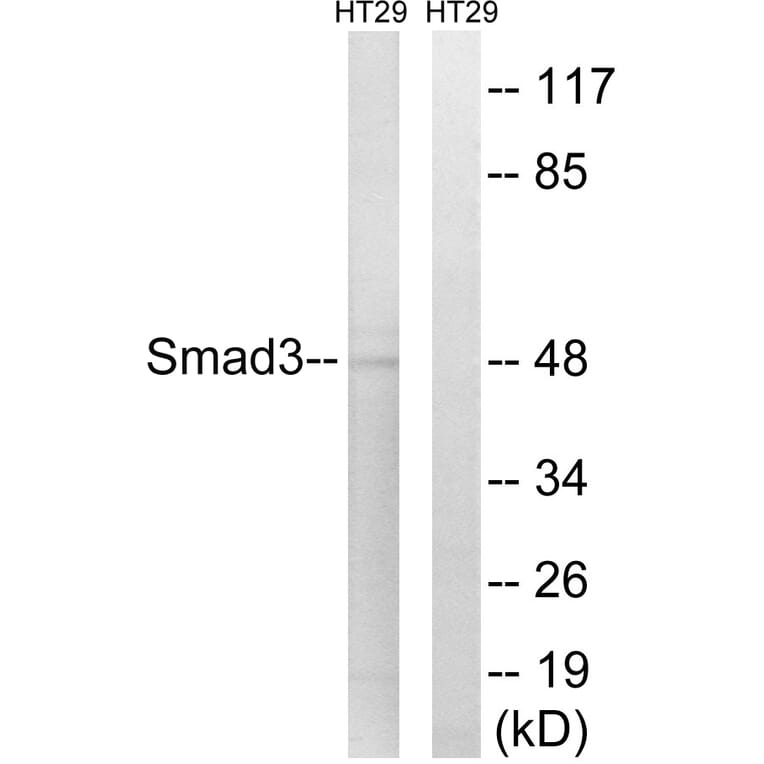 Western Blot - Anti-Smad3 Antibody (B1003) - Antibodies.com