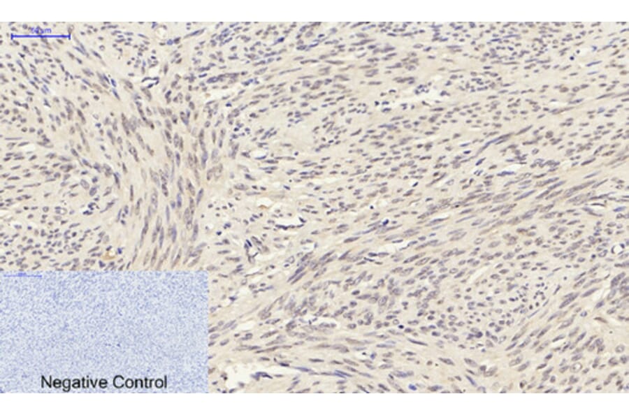 Immunohistochemistry - Anti-Smad3 Antibody (B1003) - Antibodies.com