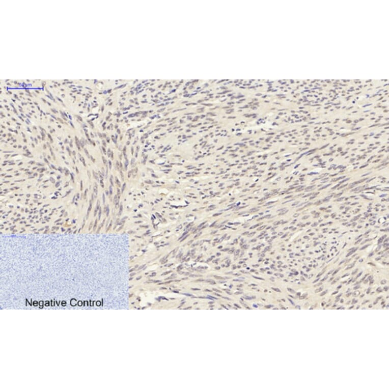 Immunohistochemistry - Anti-Smad3 Antibody (B1003) - Antibodies.com