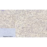 Immunohistochemistry - Anti-Smad3 Antibody (B1003) - Antibodies.com