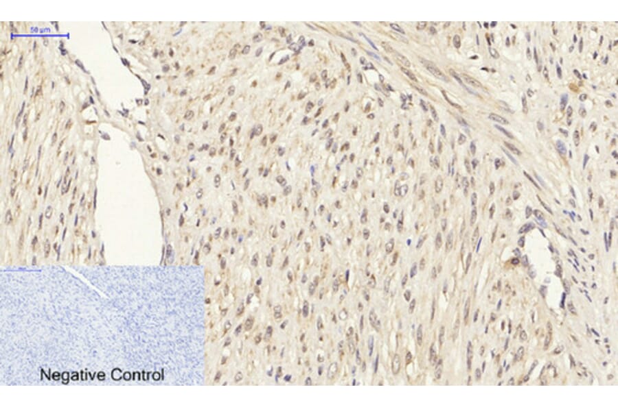 Immunohistochemistry - Anti-Smad3 Antibody (B1003) - Antibodies.com