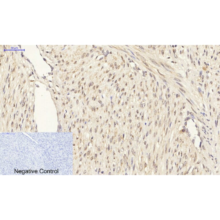 Immunohistochemistry - Anti-Smad3 Antibody (B1003) - Antibodies.com