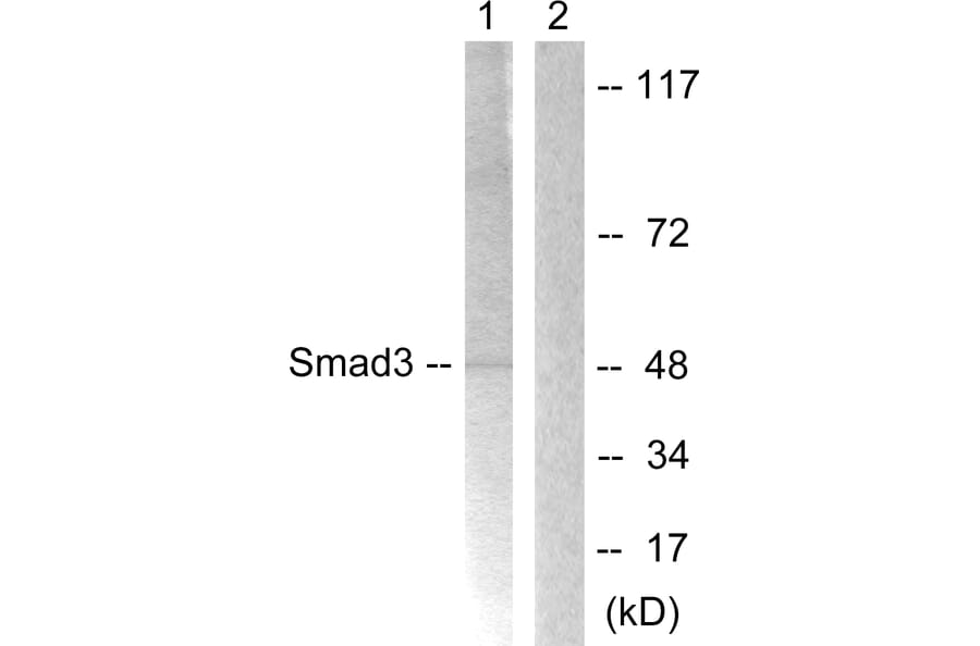 Western Blot - Anti-Smad3 Antibody (B1007) - Antibodies.com
