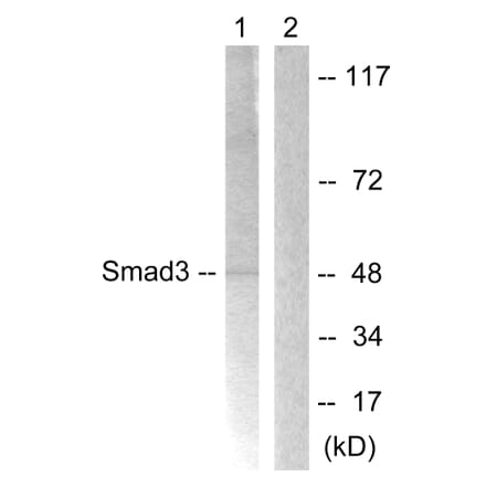 Western Blot - Anti-Smad3 Antibody (B1007) - Antibodies.com