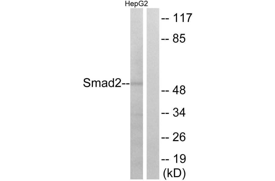 Western Blot - Anti-Smad2 Antibody (B0997) - Antibodies.com