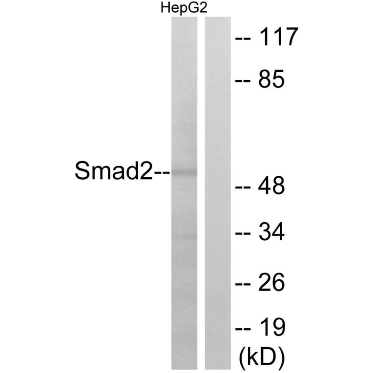 Western Blot - Anti-Smad2 Antibody (B0997) - Antibodies.com