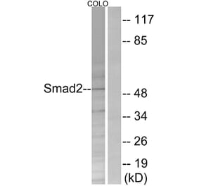 Western Blot - Anti-Smad2 Antibody (B0998) - Antibodies.com