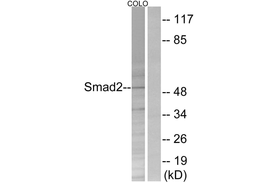 Western Blot - Anti-Smad2 Antibody (B0998) - Antibodies.com