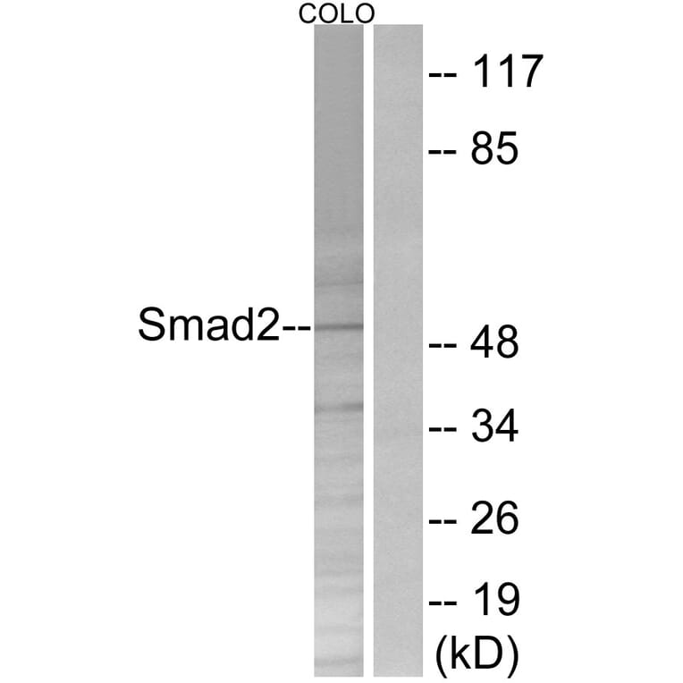 Western Blot - Anti-Smad2 Antibody (B0998) - Antibodies.com
