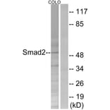 Western Blot - Anti-Smad2 Antibody (B0998) - Antibodies.com