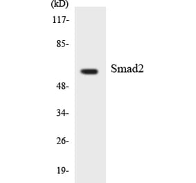Western Blot - Anti-Smad2 Antibody (R12-3545) - Antibodies.com
