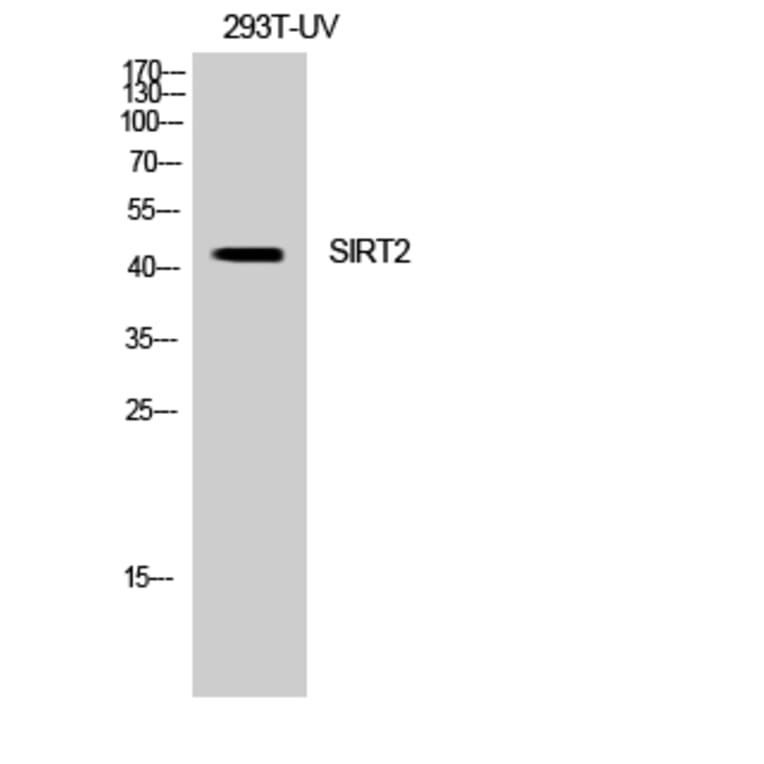 Western Blot - Anti-SIRT2 Antibody (C21067) - Antibodies.com