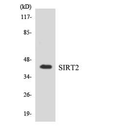 Western Blot - Anti-SIRT2 Antibody (R12-3509) - Antibodies.com