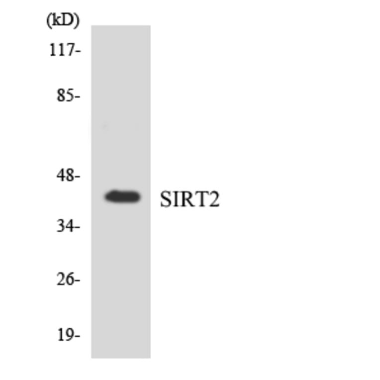 Western Blot - Anti-SIRT2 Antibody (R12-3509) - Antibodies.com