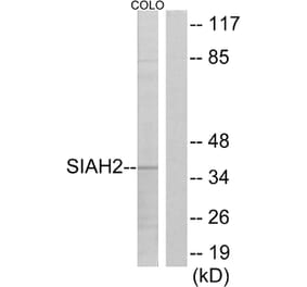 Western Blot - Anti-SIAH2 Antibody (C19672) - Antibodies.com