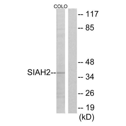 Western Blot - Anti-SIAH2 Antibody (C19672) - Antibodies.com
