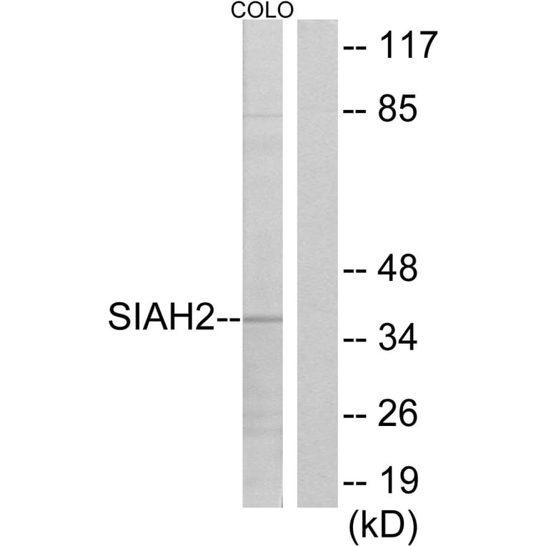 Western Blot - Anti-SIAH2 Antibody (C19672) - Antibodies.com