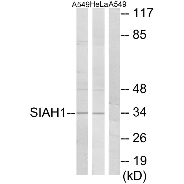 Western Blot - Anti-SIAH1 Antibody (C11300) - Antibodies.com