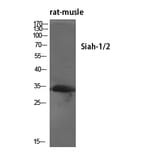 Western Blot - Anti-SIAH1 Antibody (C11300) - Antibodies.com