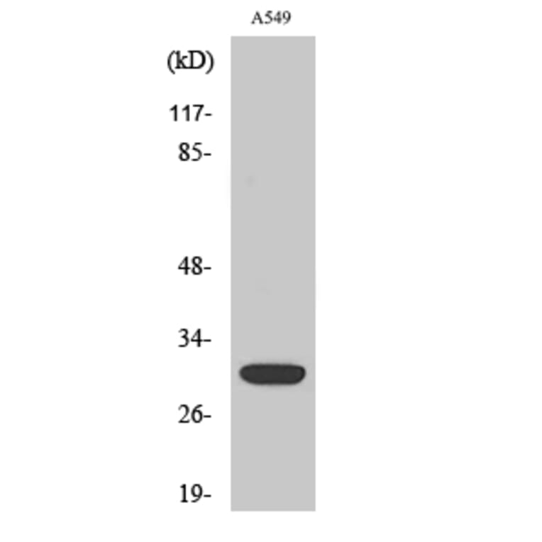 Western Blot - Anti-SIAH1 Antibody (C11300) - Antibodies.com