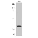 Western Blot - Anti-SIAH1 Antibody (C11300) - Antibodies.com