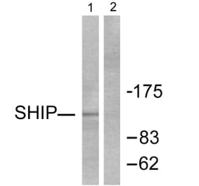 Western Blot - Anti-SHIP1 Antibody (C0320) - Antibodies.com