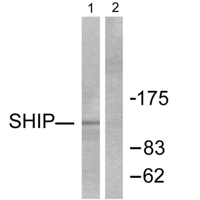 Western Blot - Anti-SHIP1 Antibody (C0320) - Antibodies.com