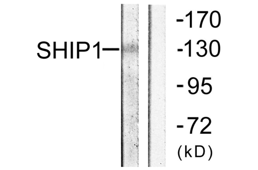 Western Blot - Anti-SHIP1 Antibody (B0738) - Antibodies.com