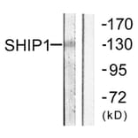 Western Blot - Anti-SHIP1 Antibody (B0738) - Antibodies.com