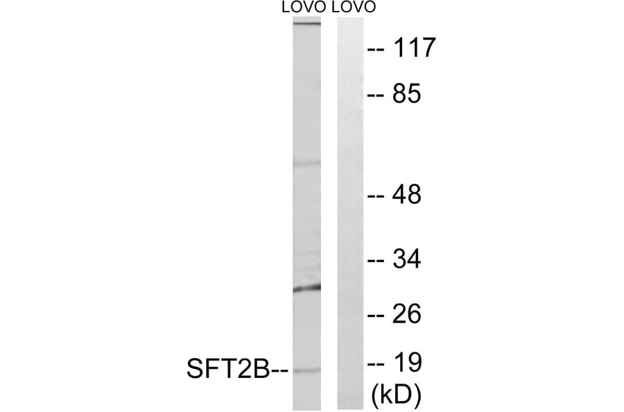 Western Blot - Anti-SFT2B Antibody (C19499) - Antibodies.com