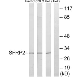 Western Blot - Anti-SFRP2 Antibody (C18484) - Antibodies.com