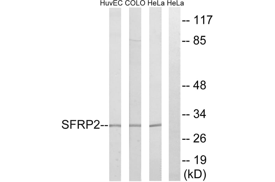 Western Blot - Anti-SFRP2 Antibody (C18484) - Antibodies.com