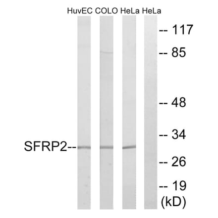 Western Blot - Anti-SFRP2 Antibody (C18484) - Antibodies.com