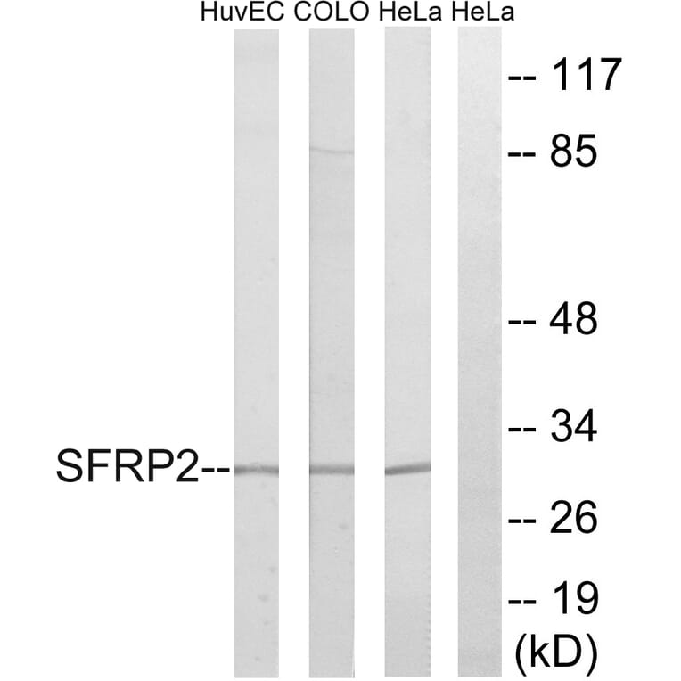 Western Blot - Anti-SFRP2 Antibody (C18484) - Antibodies.com