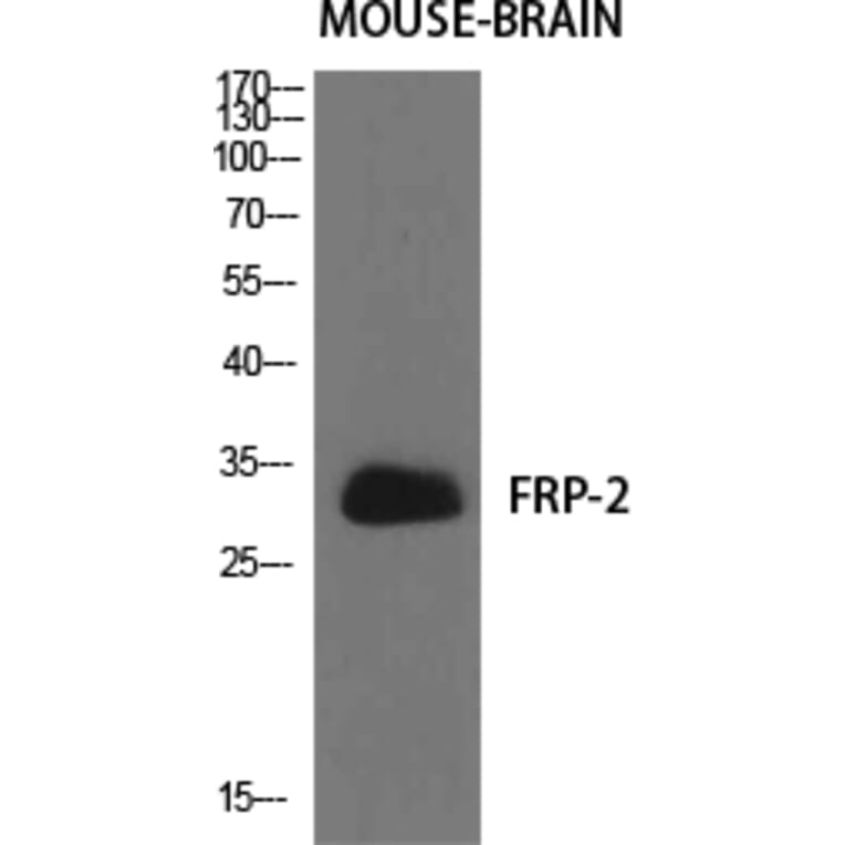 Western Blot - Anti-SFRP2 Antibody (C18484) - Antibodies.com