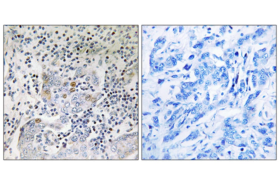 Immunohistochemistry - Anti-SESN1 Antibody (C18691) - Antibodies.com