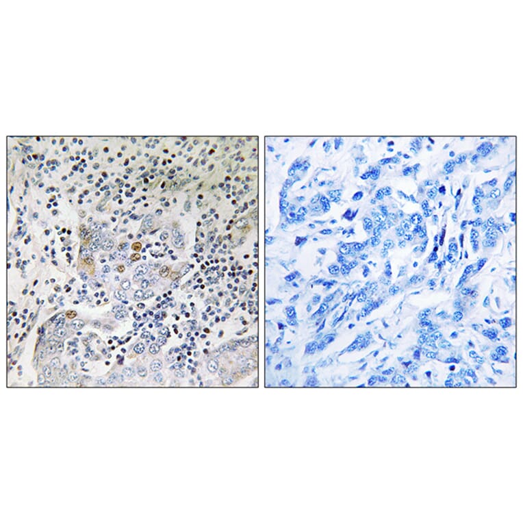 Immunohistochemistry - Anti-SESN1 Antibody (C18691) - Antibodies.com
