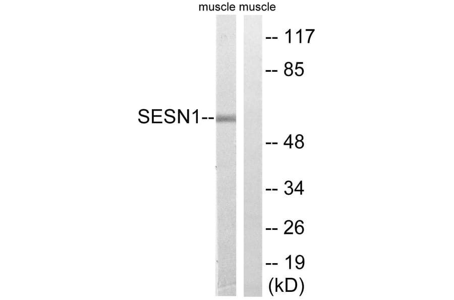 Western Blot - Anti-SESN1 Antibody (C18691) - Antibodies.com