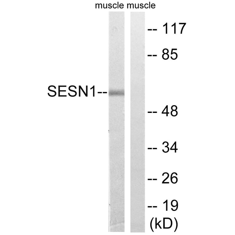 Western Blot - Anti-SESN1 Antibody (C18691) - Antibodies.com