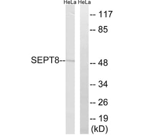 Western Blot - Anti-SEPT8 Antibody (C18514) - Antibodies.com