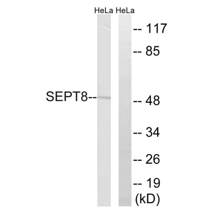 Western Blot - Anti-SEPT8 Antibody (C18514) - Antibodies.com