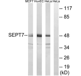 Western Blot - Anti-SEPT7 Antibody (C18513) - Antibodies.com