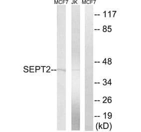 Western Blot - Anti-SEPT2 Antibody (C18509) - Antibodies.com