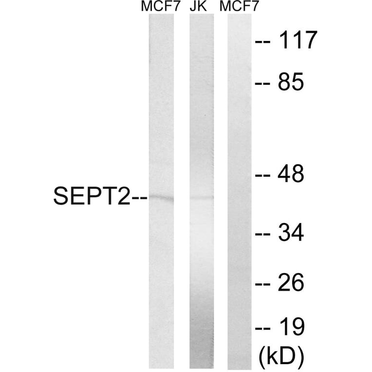 Western Blot - Anti-SEPT2 Antibody (C18509) - Antibodies.com