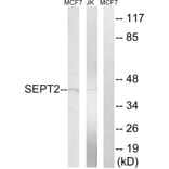 Western Blot - Anti-SEPT2 Antibody (C18509) - Antibodies.com