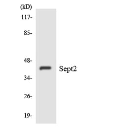 Western Blot - Anti-SEPT2 Antibody (R12-3489) - Antibodies.com