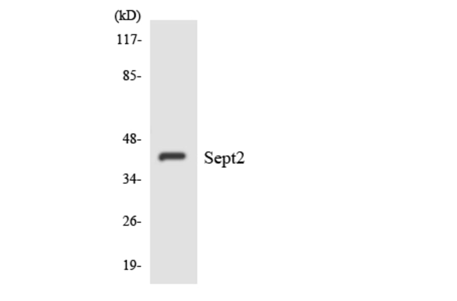 Western Blot - Anti-SEPT2 Antibody (R12-3489) - Antibodies.com