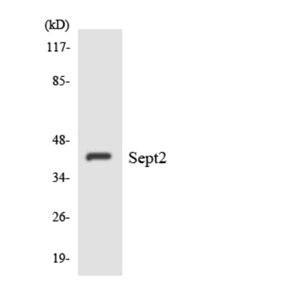 Western Blot - Anti-SEPT2 Antibody (R12-3489) - Antibodies.com