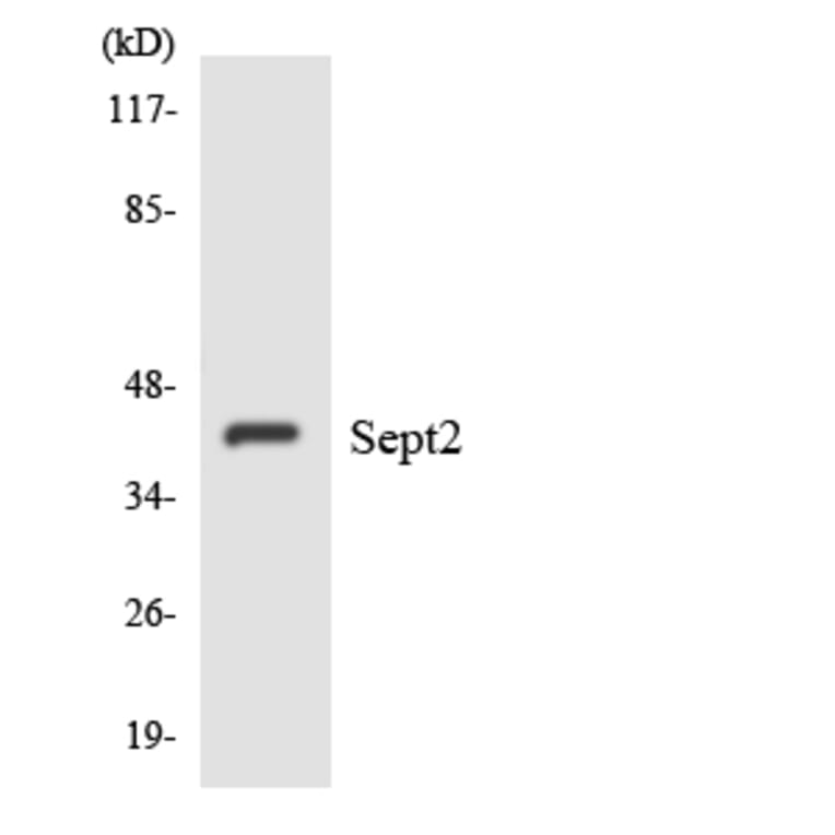 Western Blot - Anti-SEPT2 Antibody (R12-3489) - Antibodies.com