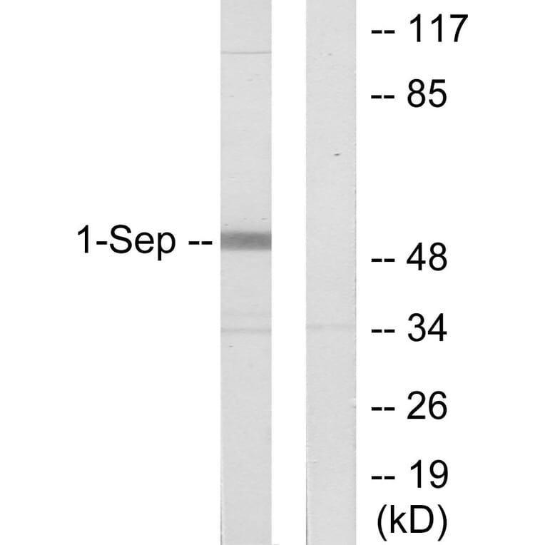 Western Blot - Anti-SEPT1 Antibody (C11420) - Antibodies.com